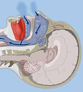 Cross-section of normal breathing and sleep-disordered breathing