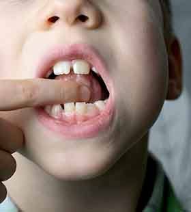 Young boy performing tongue stretches