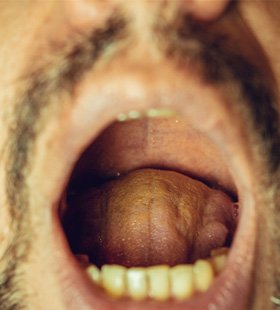 Up-close view of an adult’s relaxed throat tissues