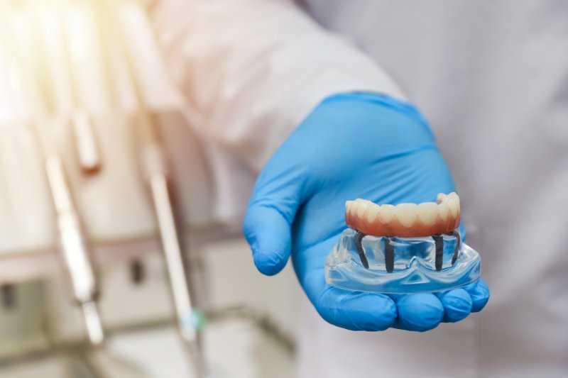 dentist holding a mouth mold with dental implants